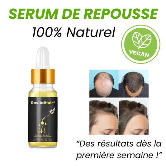 Serum de Repousse Capillaire | Cure de 6 Mois - RevitalHair®